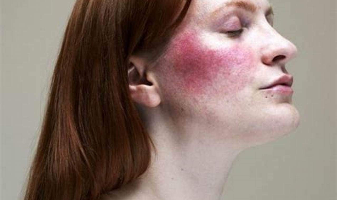 Cara Mengatasi Skin Barrier Yang Rusak
